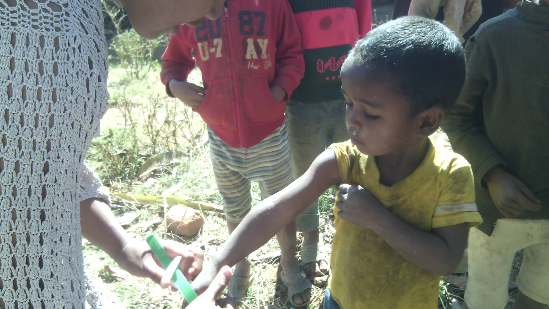 Lotta alla malnutrizione in Madagascar di Change Onlus Lotta alla malnutrizione in Madagascar-Change Onlus