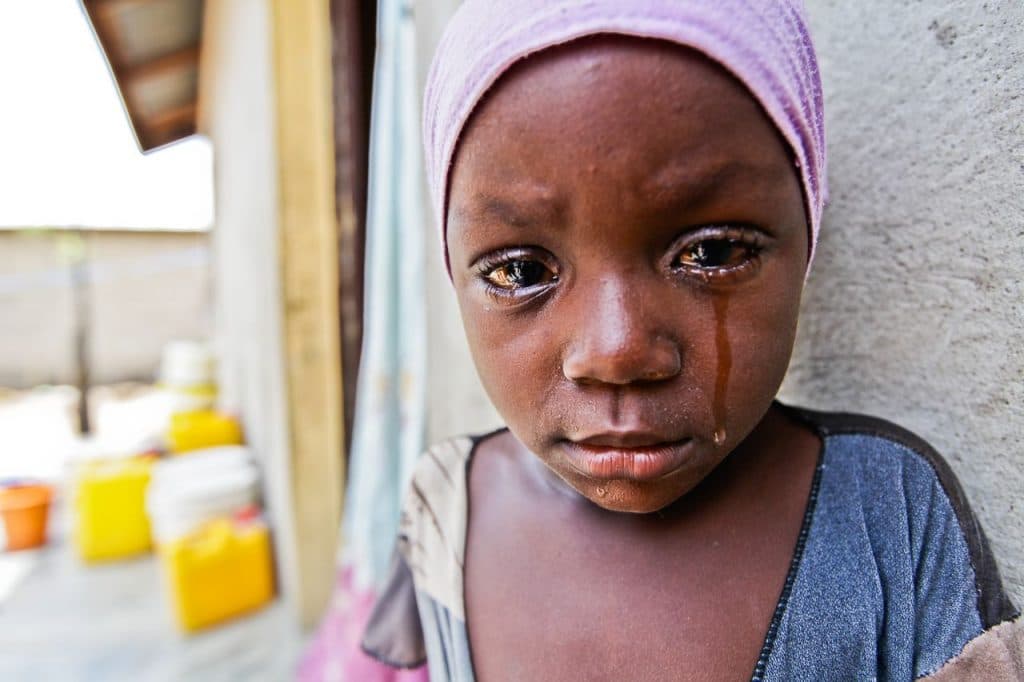 Fermiamo il tracoma per sempre! di Sightsavers Italia Onlus Fermiamo il tracoma per sempre!-Sightsavers Italia Onlus