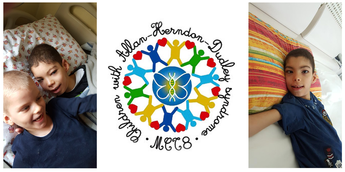 Corriamo per UNA VITA RARA-ASD ATLETICA FRANCIACORTA