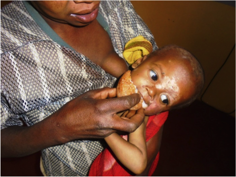 Storia di Edmond: lotta contro la fame. di Antonio Brienza Storia di Edmond: lotta contro la fame.-Antonio Brienza