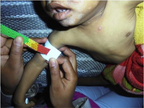 Storia di Edmond: lotta contro la fame. di Antonio Brienza Storia di Edmond: lotta contro la fame.-Antonio Brienza