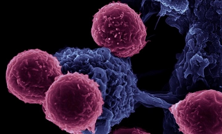 Aiutiamo tutti noi la ricerca-Roberto Medri