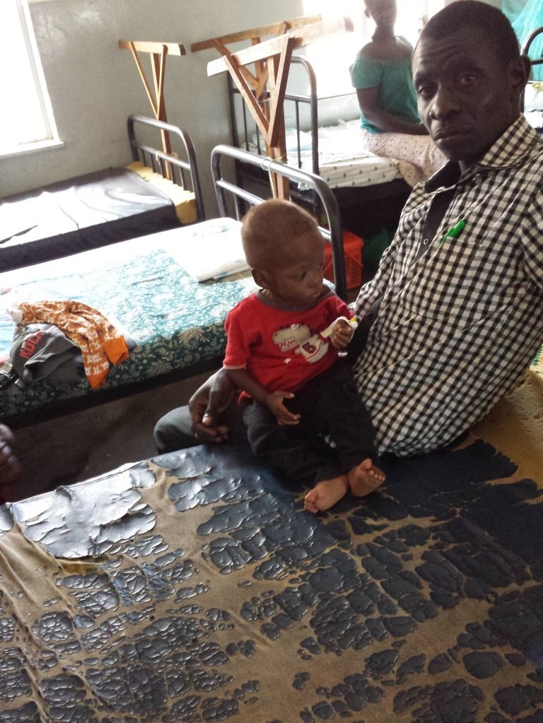 Combattiamo la Malnutrizione Infantile-NutriAfrica