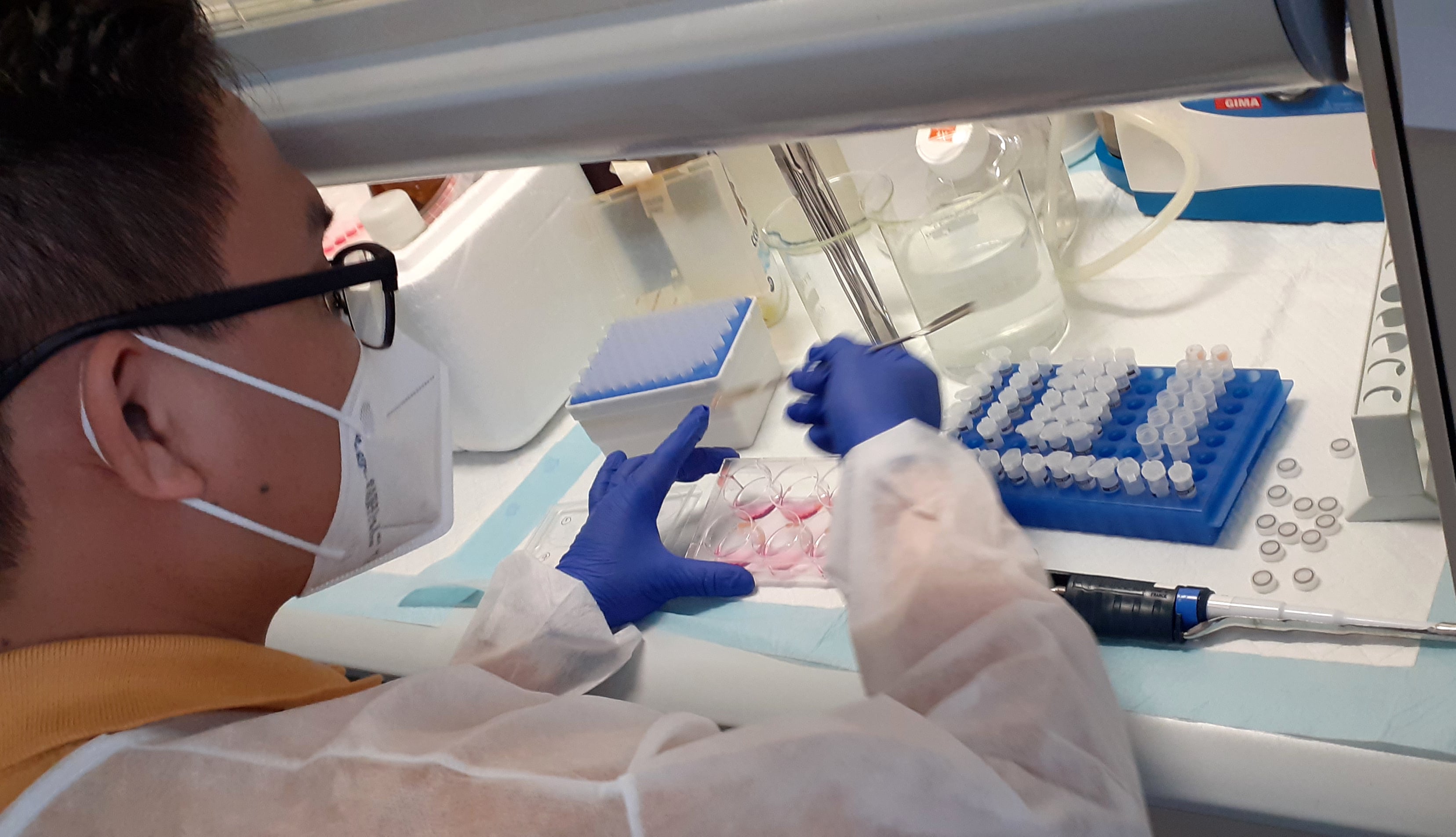 Progetto LIVER-BRAIN "Rita Moretti"-Fondazione Italiana Fegato - FIF Onlus