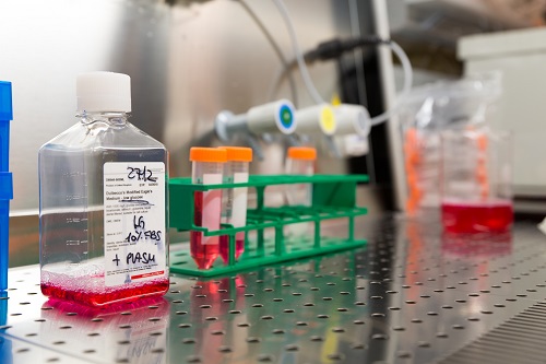 Sostieni la ricerca contro la leucemia-Ospedale San Raffaele Milano