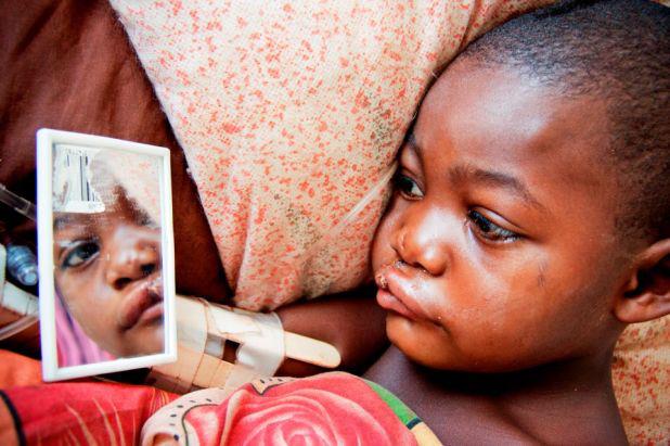 Un Sorriso, traguardo raggiungibile di Fondazione Operation Smile Italia Onlus Un Sorriso, traguardo raggiungibile-Fondazione Operation Smile Italia Onlus