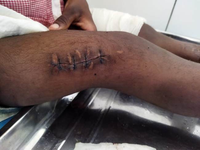 Dispensario diabetici di Hell Ville di Giovanna per il Madagascar Dispensario diabetici di Hell Ville-Giovanna per il Madagascar