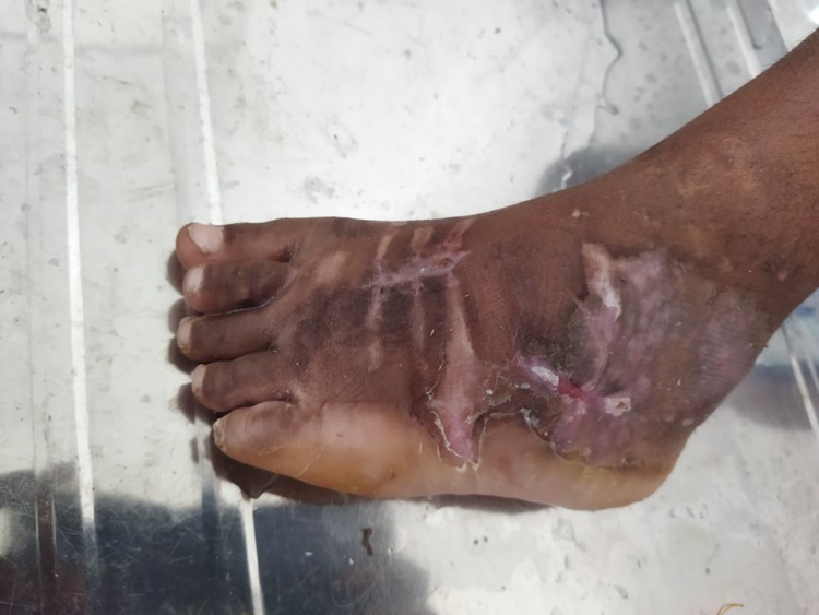 Dispensario diabetici di Hell Ville di Giovanna per il Madagascar Dispensario diabetici di Hell Ville-Giovanna per il Madagascar