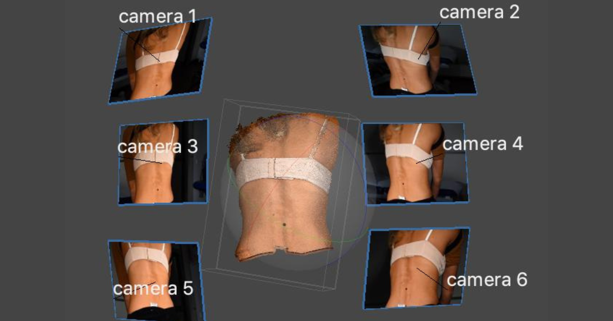 Sostieni la prevenzione del melanoma di Associazione Piccoli Punti Sostieni la prevenzione del melanoma -Associazione Piccoli Punti