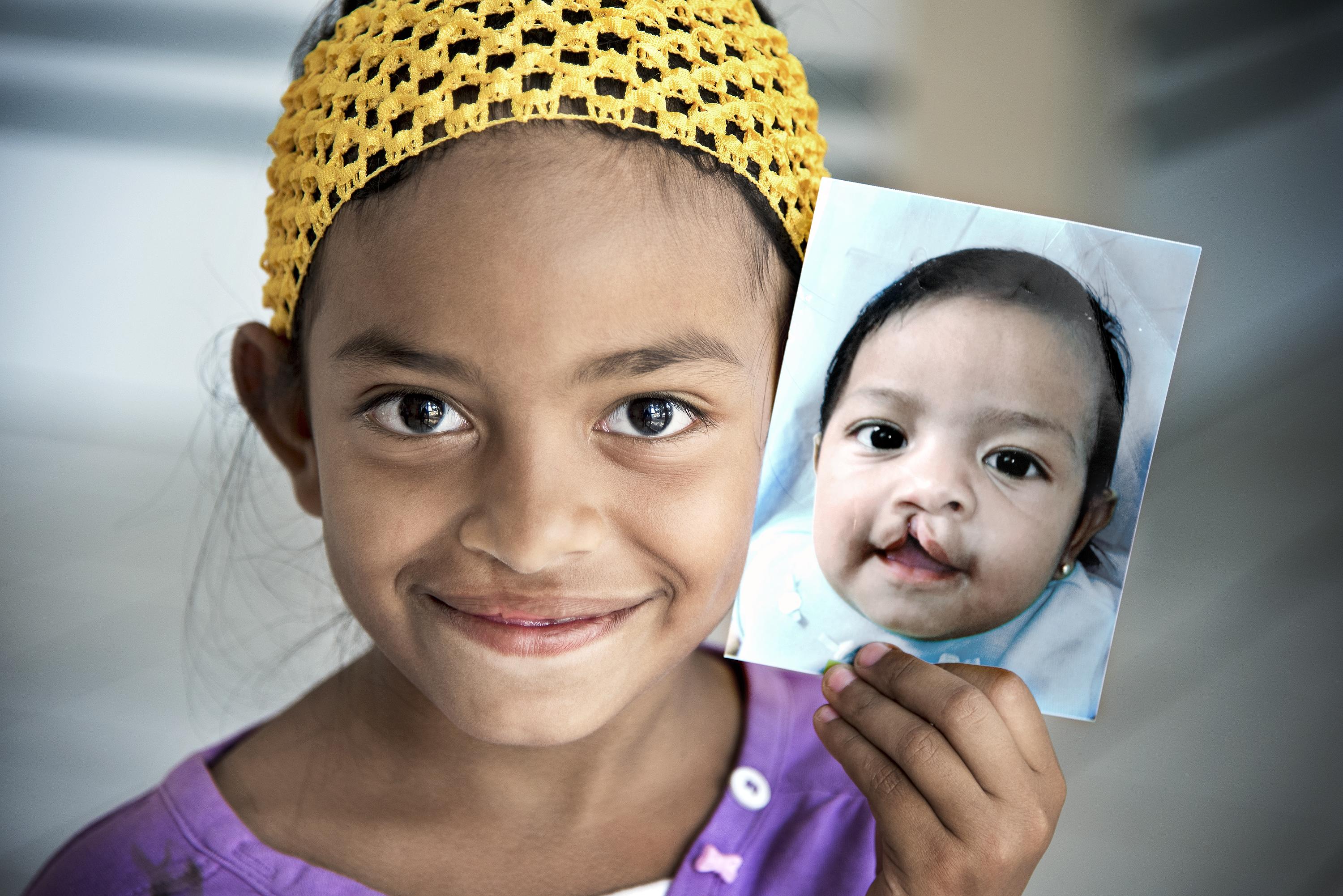 20 NUOVI SORRISI PER L’HONDURAS di Fondazione Operation Smile Italia Onlus 20 NUOVI SORRISI PER L’HONDURAS-Fondazione Operation Smile Italia Onlus