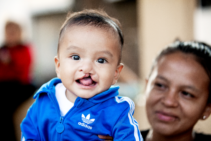 20 NUOVI SORRISI PER L’HONDURAS di Fondazione Operation Smile Italia Onlus 20 NUOVI SORRISI PER L’HONDURAS-Fondazione Operation Smile Italia Onlus