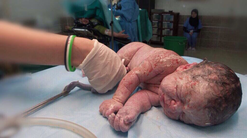 Medical Center Pediatrico Azaz (Siria) di "We Are" Onlus Medical Center Pediatrico Azaz (Siria)-"We Are" Onlus