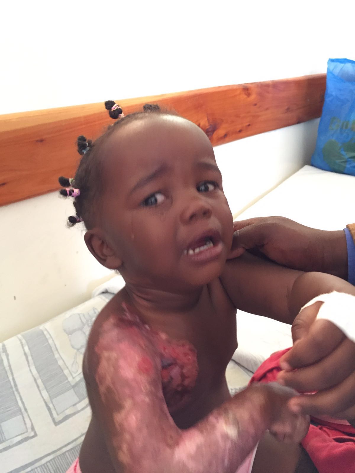 "Dona un sorriso ai bambini ustionati"-Padova Ospitale onlus