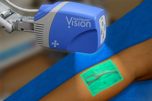 Vein Viewer