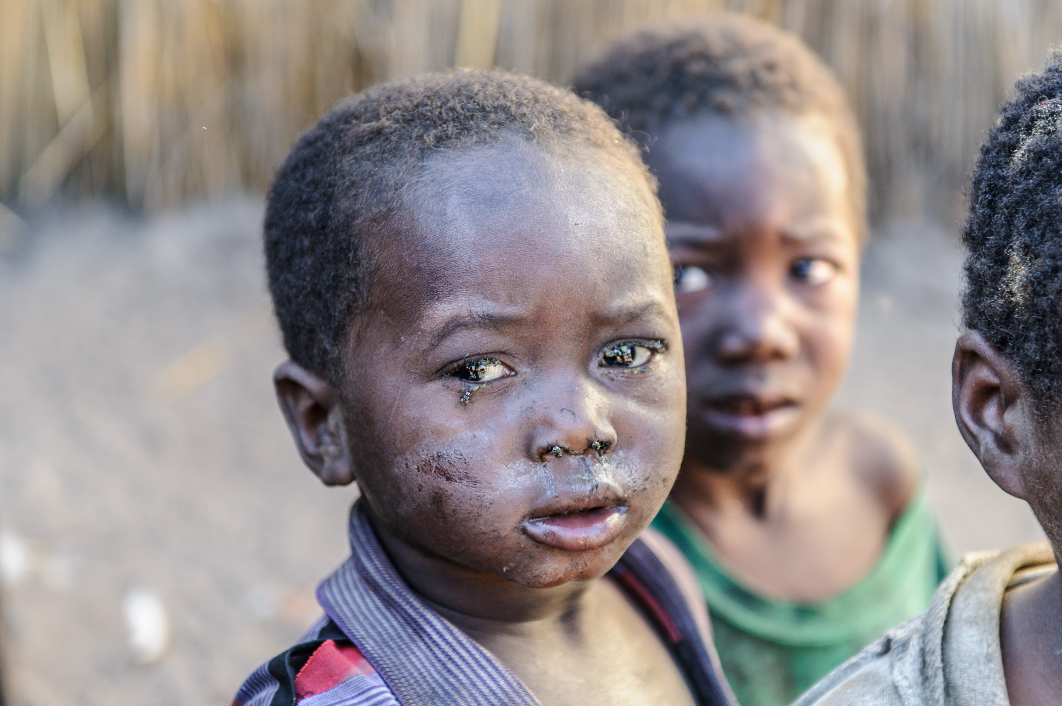 Ferma il tracoma per sempre!-Sightsavers Italia Onlus