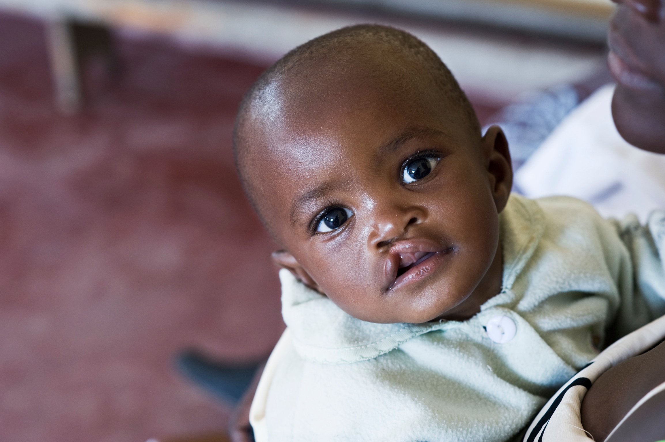 Un Sorriso, traguardo raggiungibile-Fondazione Operation Smile Italia Onlus