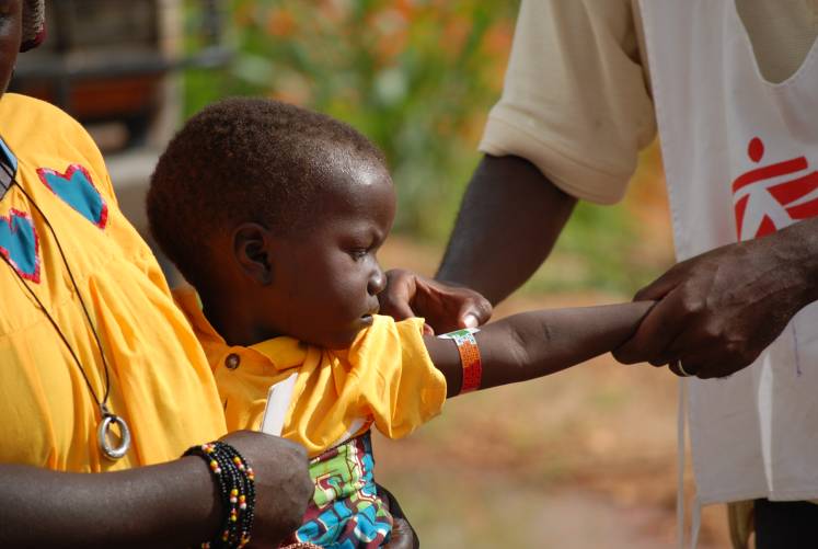 Malnutrizione infantile in Niger di Medici Senza Frontiere Malnutrizione infantile in Niger-Medici Senza Frontiere