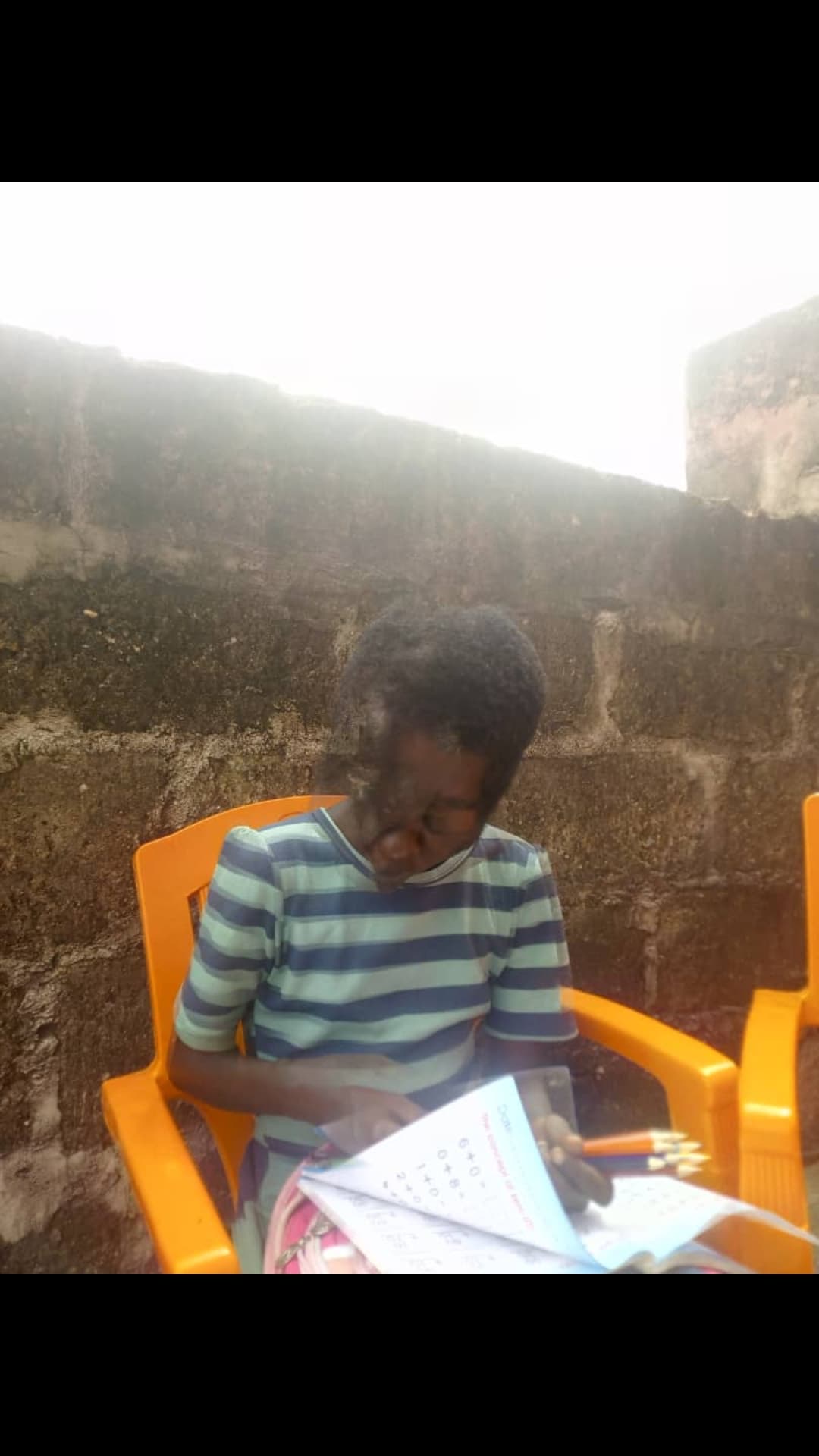 ATTIVIAMOCI TUTTI PER TINA-Linfa+Ananas contro le neurofibromatosi 